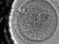 blastocyst-o